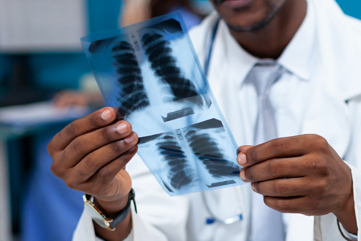 Danpong X ray copy